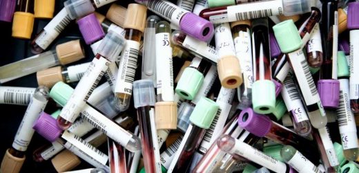 COVID transmission influenced by blood transmission rules
