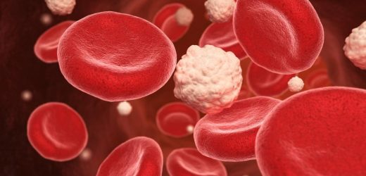 Can meal times affect your risk of glucose intolerance?