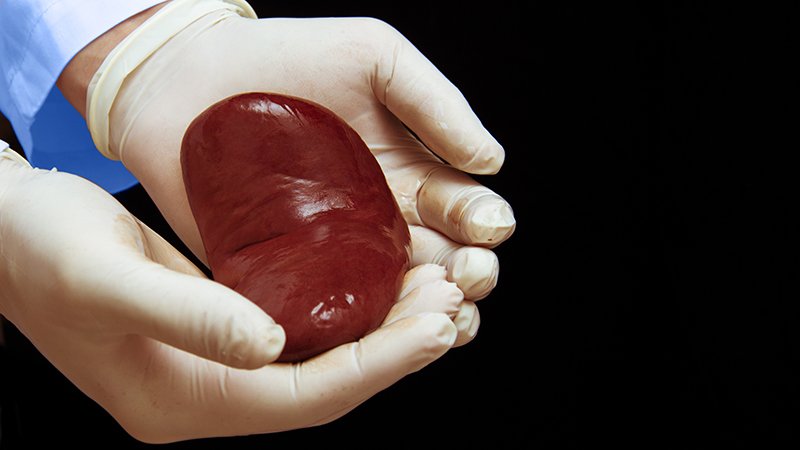 Kidneys From Donors With AKI Often Unnecessarily Discarded