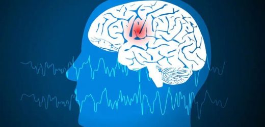 New Method Could Decrease Time Spent Localizing Epileptogenic Zones