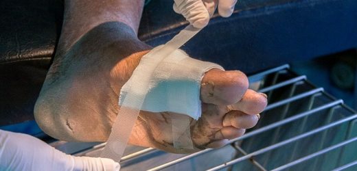 Prioritizing Diabetic Foot Care During Pandemic Pays Off