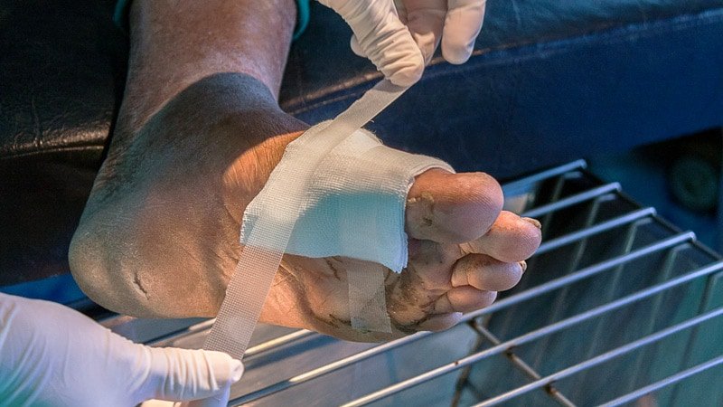 Prioritizing Diabetic Foot Care During Pandemic Pays Off