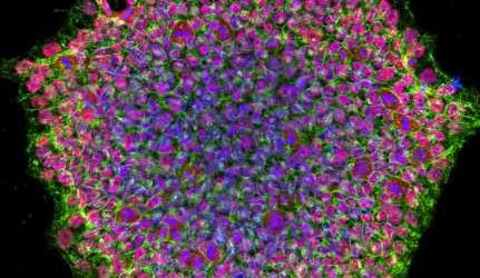 Researchers develop first stem cell model of albinism to study related eye conditions