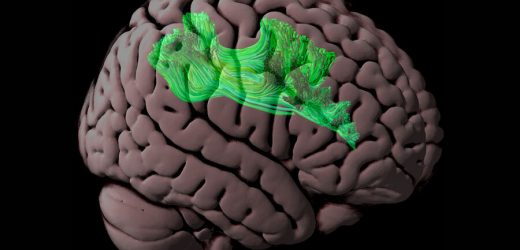 Assessing connections in the brain’s reading network