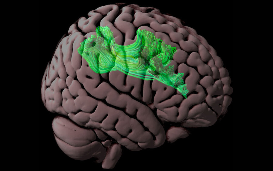 Assessing connections in the brain’s reading network