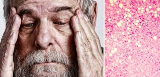 Fatty liver disease symptoms: The warning sign which shows up above waist level