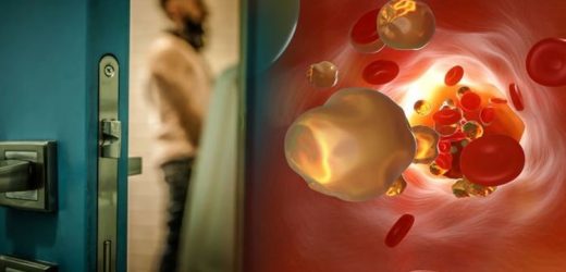 High cholesterol: High levels increase your risk of an unusual urine condition – symptoms