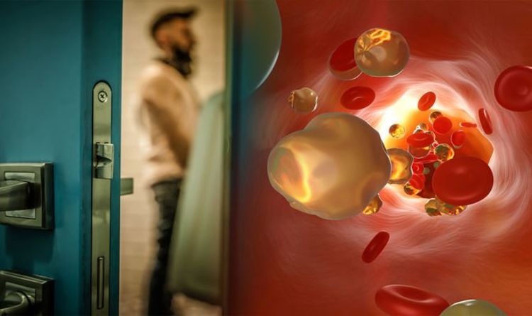 High cholesterol: High levels increase your risk of an unusual urine condition – symptoms