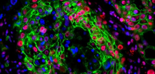 Lab results show promise for future pancreatic cancer treatment