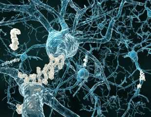 MCL1 regulates neuronal autophagy, cell survival in Alzheimer's disease