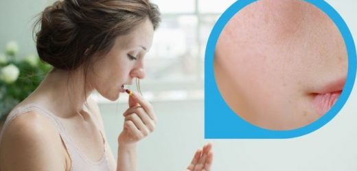 Paracetamol side effects: ‘More common’ symptom that may appear on your lips