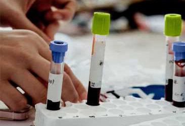 Alzheimer’s: Blood test highly accurate in large, international study