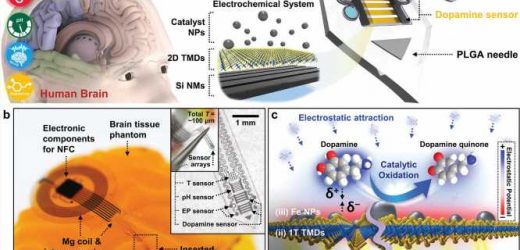 Biodegradable implant could help doctors monitor brain chemistry