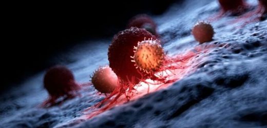 Blood cancer symptoms: What blood cancer can look like on black and brown skin