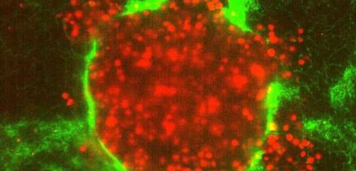 Burst of rapid cell motion in 3D tumor model could explain cancer metastasis