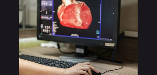 CTA Shows Safety Edge vs Cath in Intermediate-Risk Chest Pain