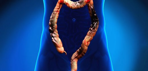 Colorectal Cancer Trials Enrolling: Could Your Patients Benefit?