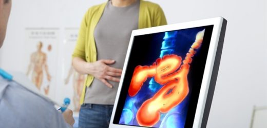 Genetic analysis reveals eosinophilic colitis as a unique disease