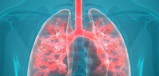 Higher BMI linked to improved lung function in cystic fibrosis