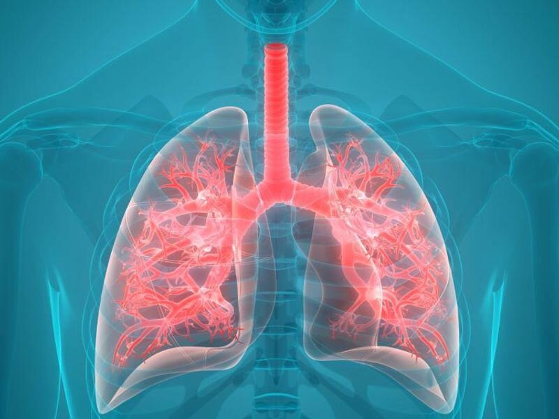 Higher BMI linked to improved lung function in cystic fibrosis