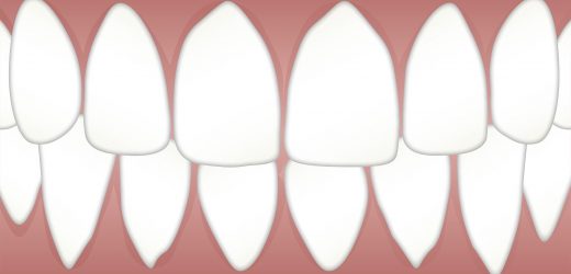 Men with periodontitis and erectile dysfunction more likely to suffer major cardiovascular event in the next four years