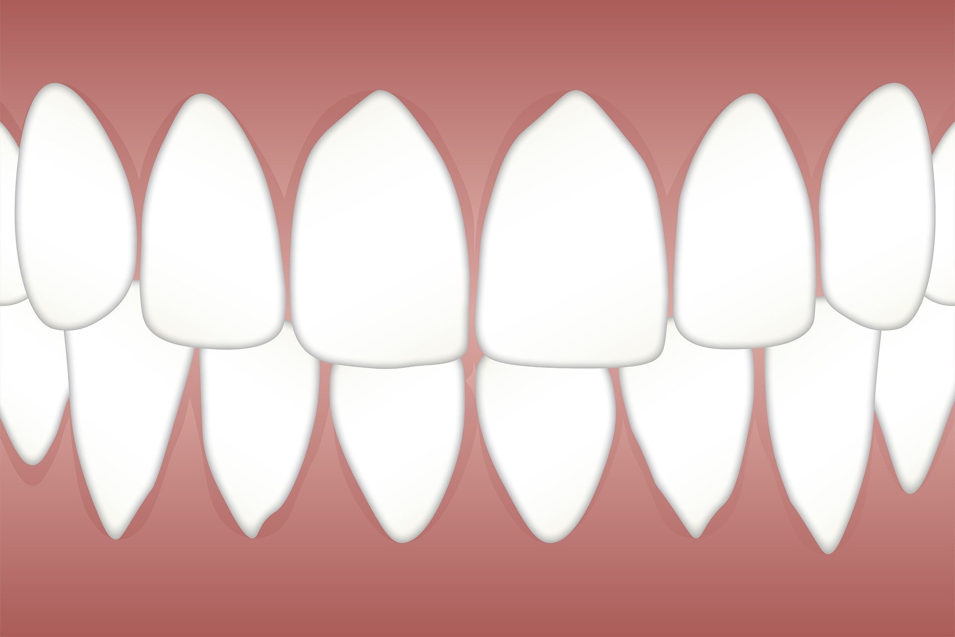 Men with periodontitis and erectile dysfunction more likely to suffer major cardiovascular event in the next four years