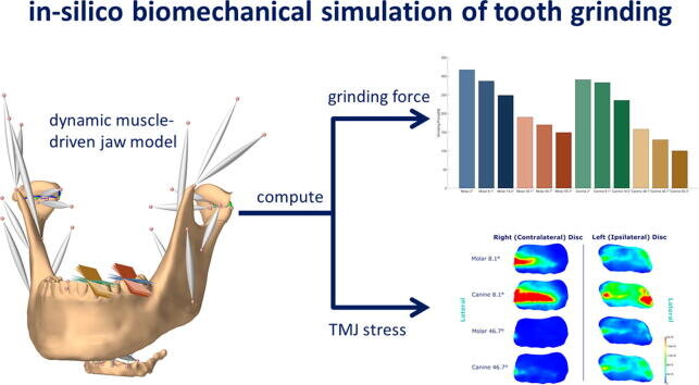 Nocturnal teeth grinding may damage temporomandibular joints