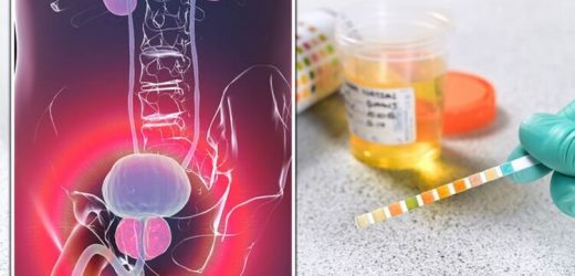 Prostate cancer symptoms: What colour is your urine? The key changes that may be a warning