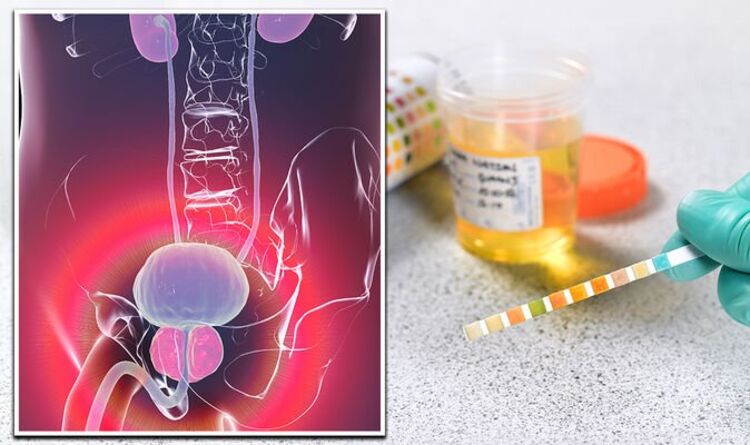 Prostate cancer symptoms: What colour is your urine? The key changes that may be a warning