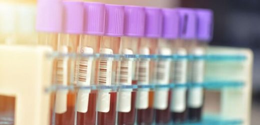 Scientists develop a new simple test that diagnoses more than 50 diseases