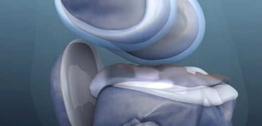 Study finds lesser satisfaction with care after knee or hip replacement among Black patients