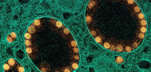 Study suggests recent common cold may actually lead to worse COVID-19 disease