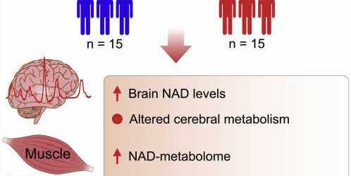 Targeting the brain’s energy metabolism may hold the key for treating Parkinson’s disease