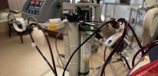 A Shortfall of ECMO Treatment Cost Lives During the Delta Surge