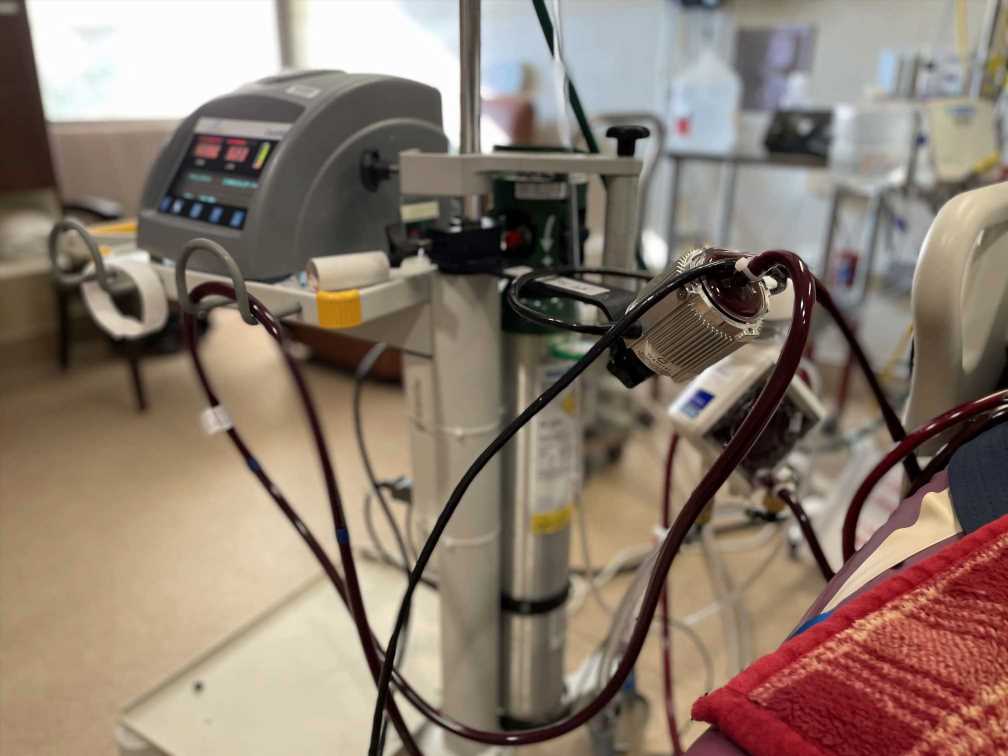 A Shortfall of ECMO Treatment Cost Lives During the Delta Surge