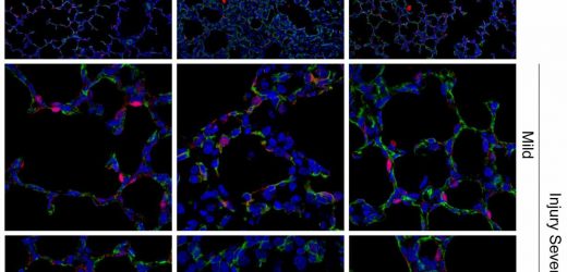 Anti-inflammatories show promise for treating a late-pregnancy complication