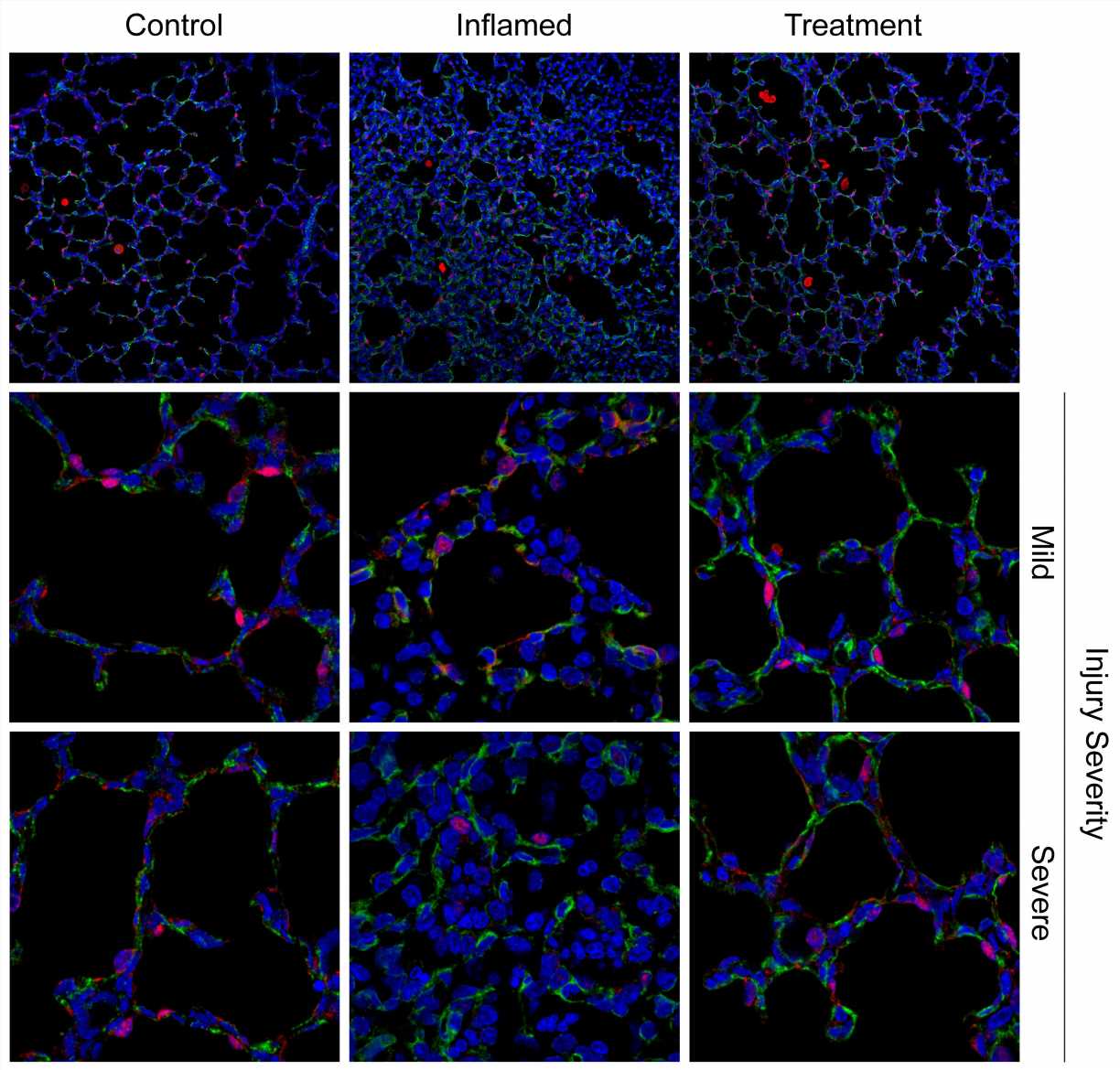 Anti-inflammatories show promise for treating a late-pregnancy complication