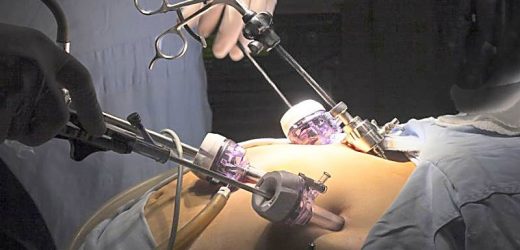 Bariatric Surgery Cuts Cardiovascular Events, Even in Seniors