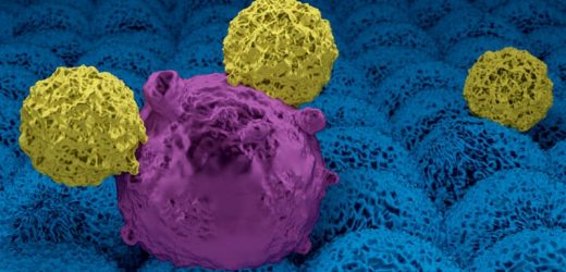 Biomarker Predicts Nonresponse to CAR T in Pediatric ALL