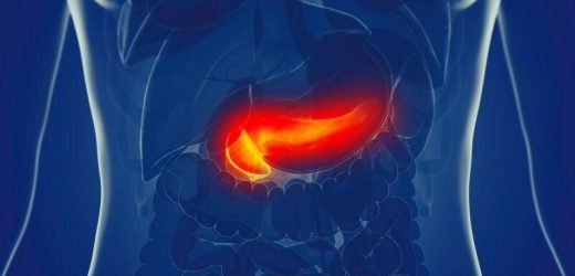Endoscopic drainage better for necrotizing pancreatitis