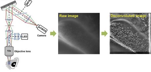 High-performance microscopy for non-invasive conjunctival goblet cell examination