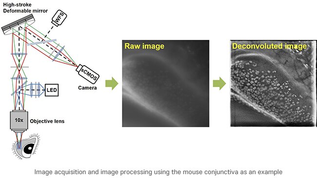 High-performance microscopy for non-invasive conjunctival goblet cell examination