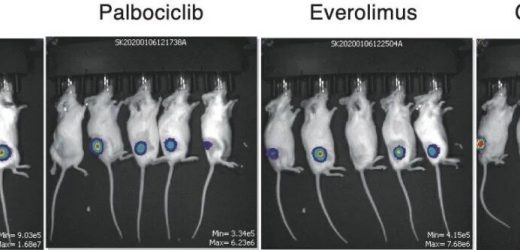 New gene targets for treating adult blood cancer