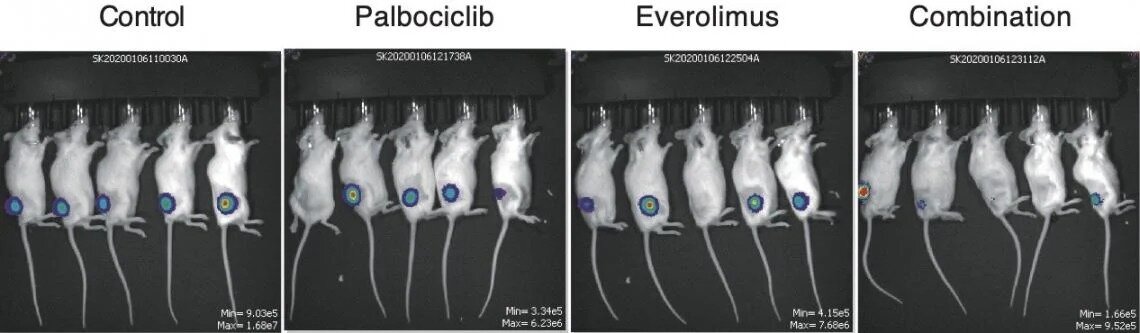 New gene targets for treating adult blood cancer