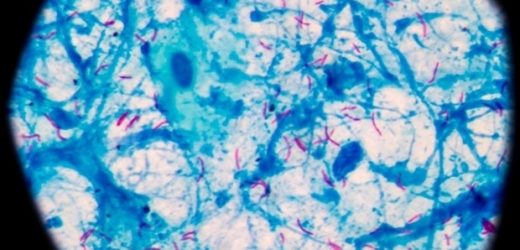 New insight into the body’s response to tuberculosis may help design a more effective vaccine