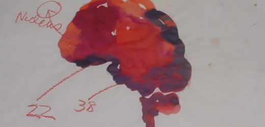 Scientists identify novel approach to preventing seizures