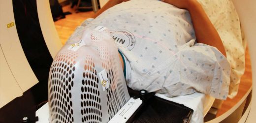 Simple changes in care reduced heart exposure during lung cancer radiation treatment