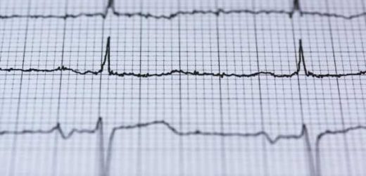 AI can help ID patients at higher risk of stroke, Mayo Clinic study finds