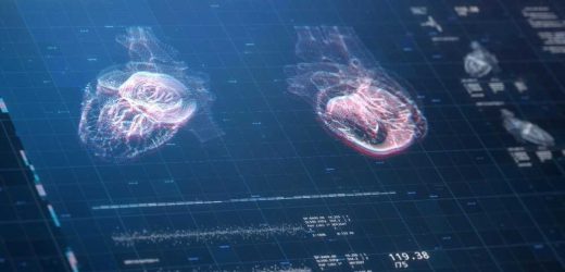 AI predicts if or when a patient could die of cardiac arrest