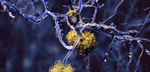 An Imminent Risk Factor for Alzheimer’s Disease?